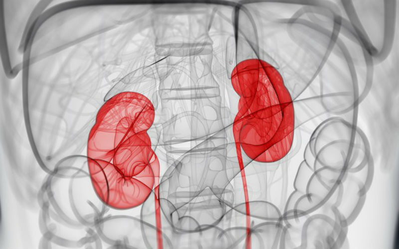 Firm develops AI-enabled clinical diagnostics for kidney disease