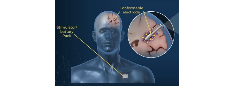 QV Bioelectronics