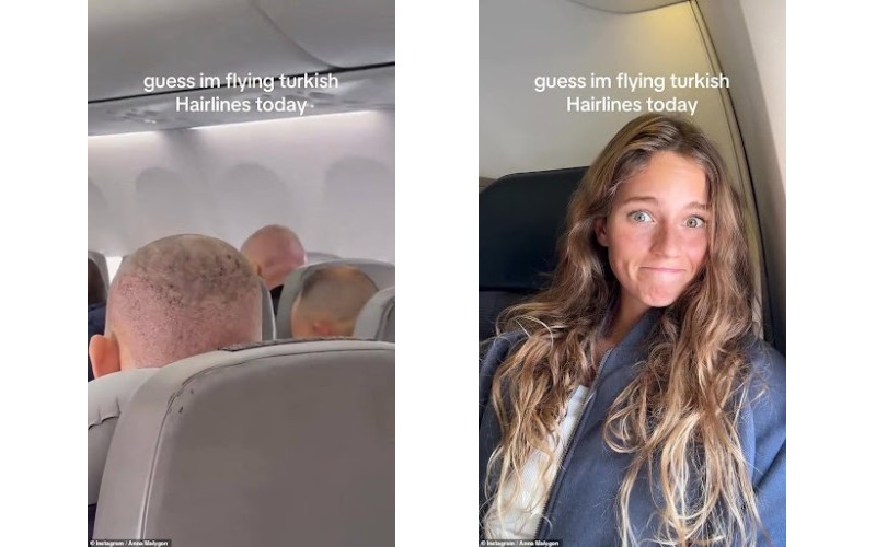 Turkish Hairlines composite